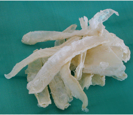 Chitosan- Herbal Extracts